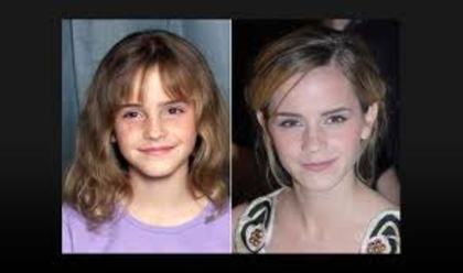 imagesCAE5QV8J - Emma Watson then and now