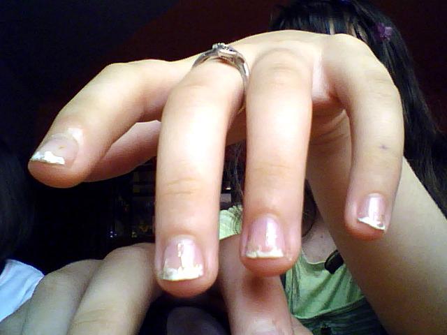 my nails - Me