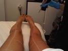 Just finished laser hair removal at Laser Away! Gotta love being Armenian!
